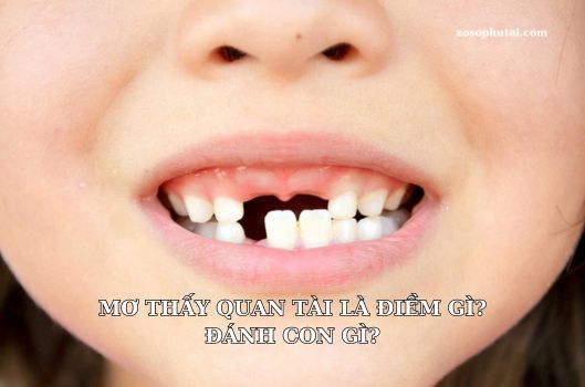 Mơ thấy mình gãy răng là điềm gì?